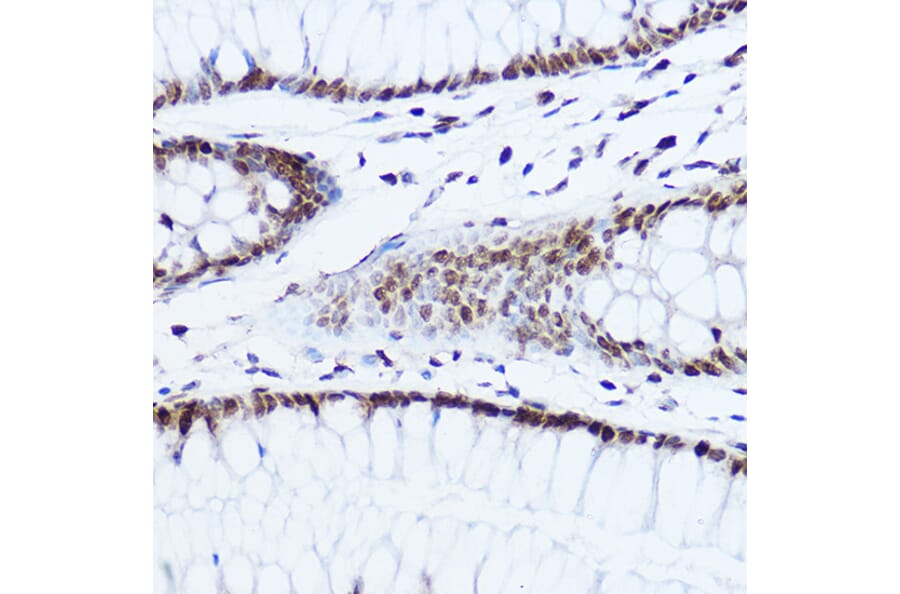 Immunohistochemistry - Anti-Histone H1.0 Antibody (A14423) - Antibodies.com