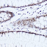 Immunohistochemistry - Anti-Histone H1.0 Antibody (A14423) - Antibodies.com