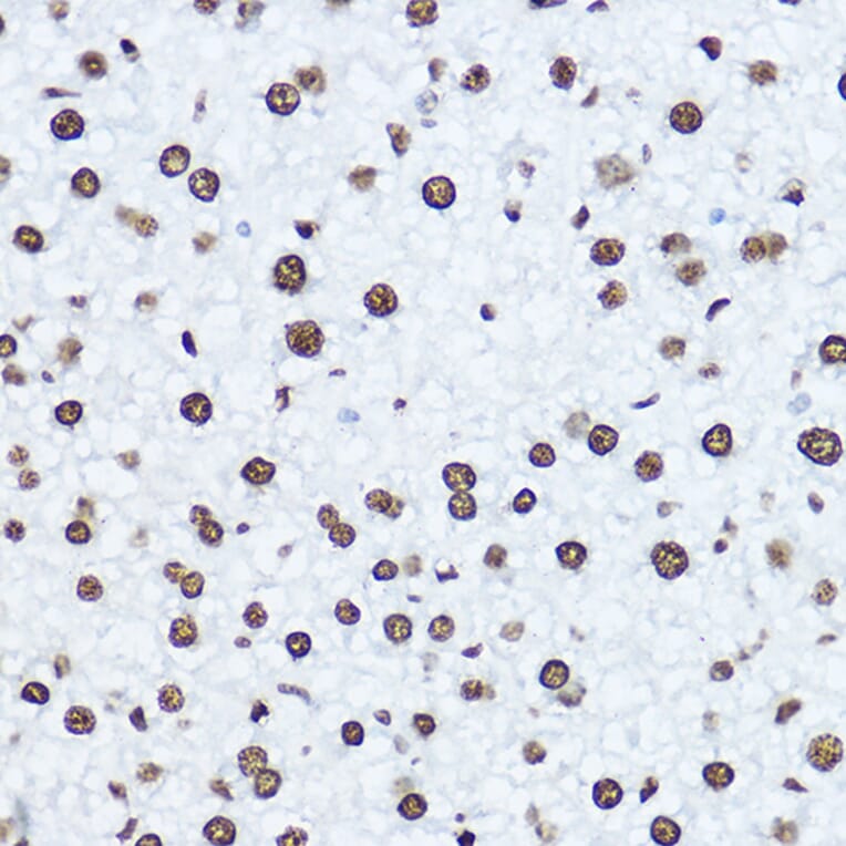 Immunohistochemistry - Anti-Histone H1.0 Antibody (A14423) - Antibodies.com