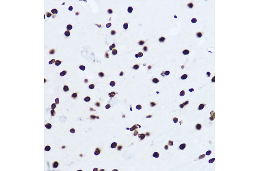 Immunohistochemistry - Anti-Histone H1.0 Antibody (A14423) - Antibodies.com