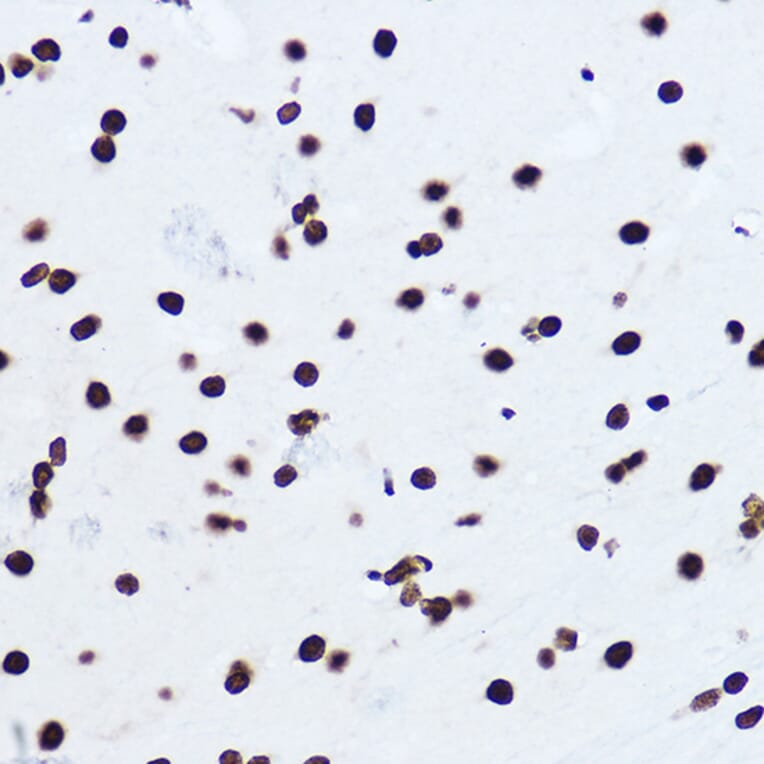 Immunohistochemistry - Anti-Histone H1.0 Antibody (A14423) - Antibodies.com