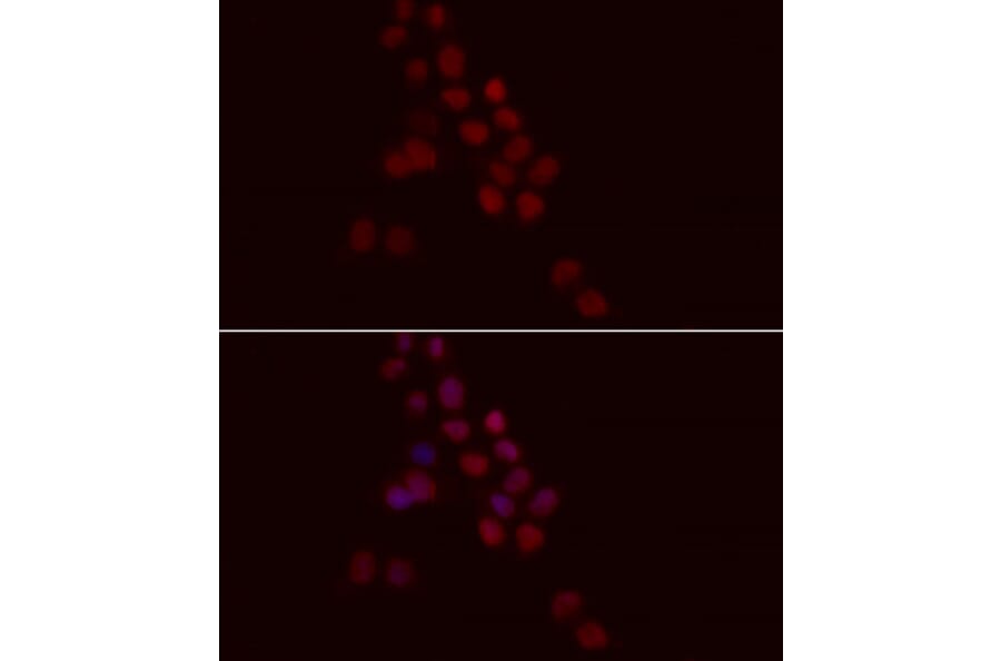 Immunofluorescence - Anti-Histone H1.0 Antibody (A14423) - Antibodies.com
