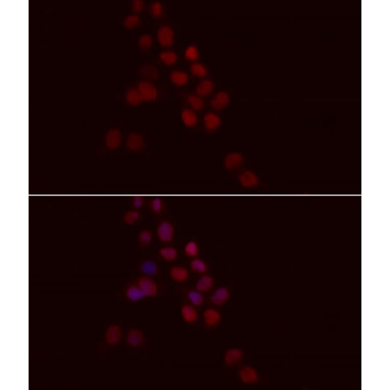 Immunofluorescence - Anti-Histone H1.0 Antibody (A14423) - Antibodies.com