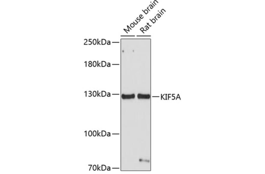 Western Blot - Anti-KIF5A Antibody (A14424) - Antibodies.com