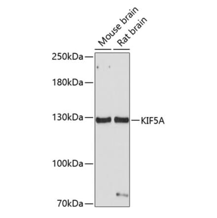 Western Blot - Anti-KIF5A Antibody (A14424) - Antibodies.com