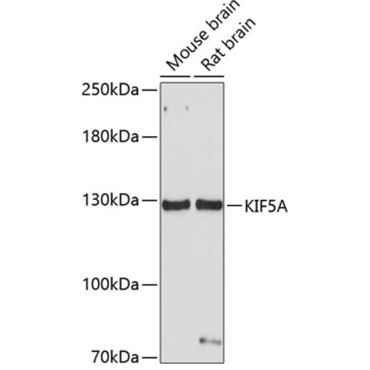Western Blot - Anti-KIF5A Antibody (A14424) - Antibodies.com