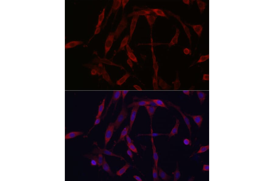 Immunofluorescence - Anti-KIF5A Antibody (A14424) - Antibodies.com