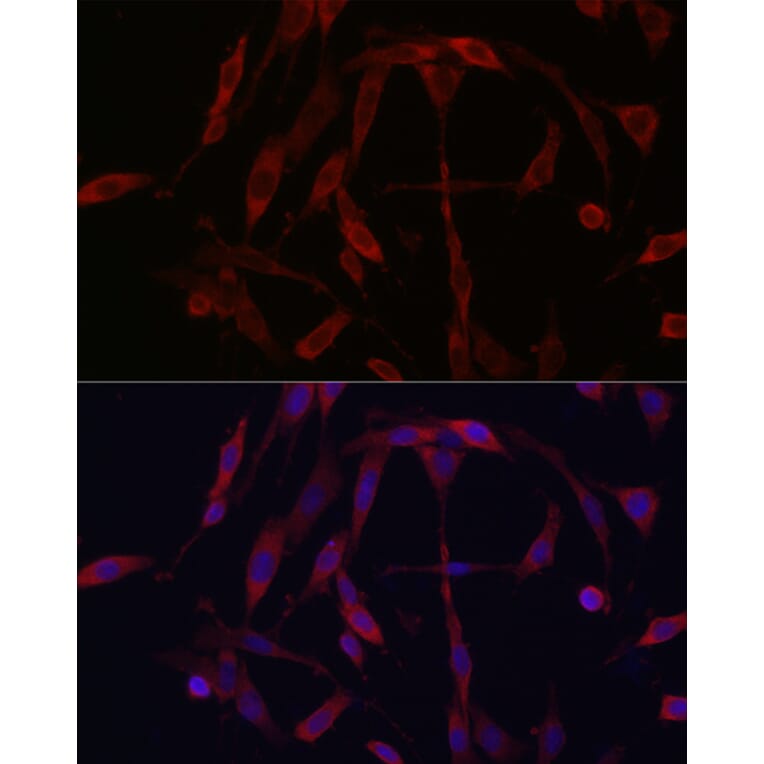 Immunofluorescence - Anti-KIF5A Antibody (A14424) - Antibodies.com