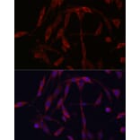 Immunofluorescence - Anti-KIF5A Antibody (A14424) - Antibodies.com