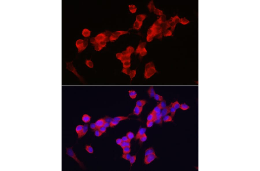 Immunofluorescence - Anti-KIF5A Antibody (A14424) - Antibodies.com
