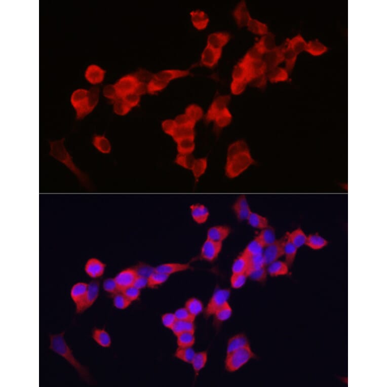 Immunofluorescence - Anti-KIF5A Antibody (A14424) - Antibodies.com