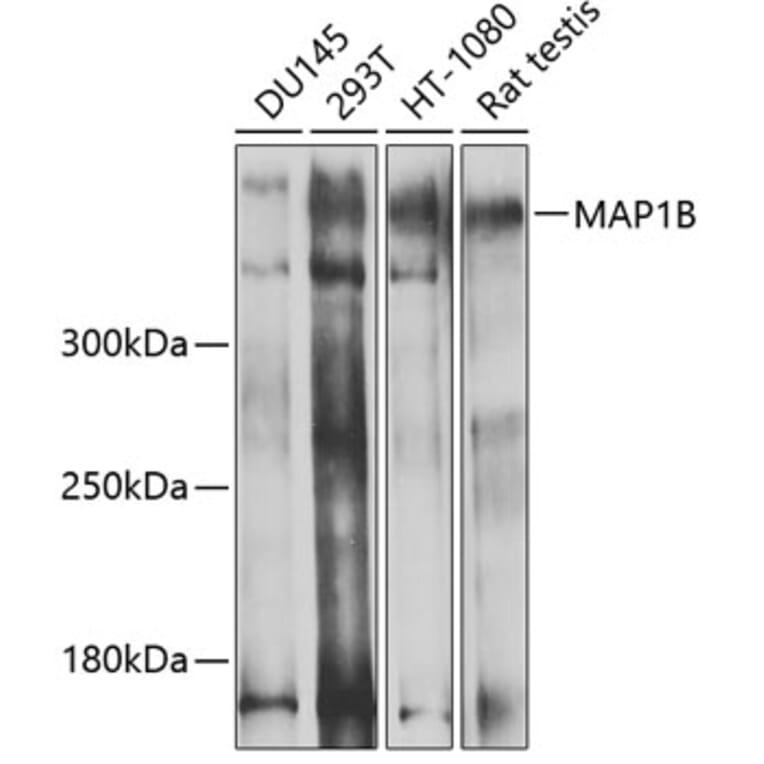 Western Blot - Anti-MAP1B Antibody (A14425) - Antibodies.com