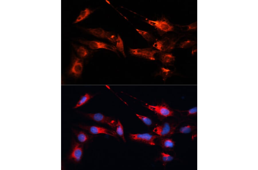 Immunofluorescence - Anti-MAP1B Antibody (A14425) - Antibodies.com