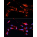 Immunofluorescence - Anti-MAP1B Antibody (A14425) - Antibodies.com