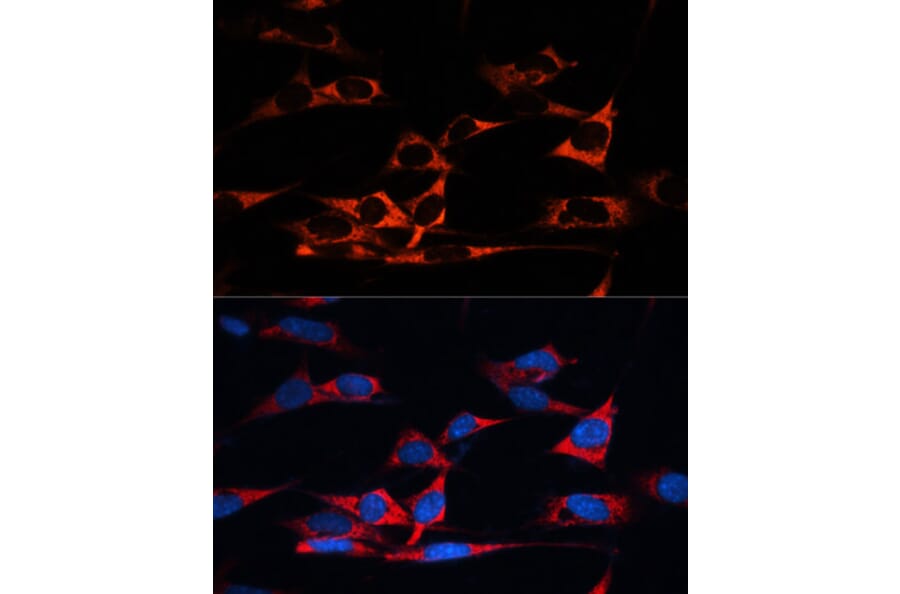 Immunofluorescence - Anti-MAP1B Antibody (A14425) - Antibodies.com