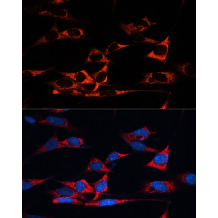 Immunofluorescence - Anti-MAP1B Antibody (A14425) - Antibodies.com