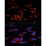 Immunofluorescence - Anti-MAP1B Antibody (A14425) - Antibodies.com