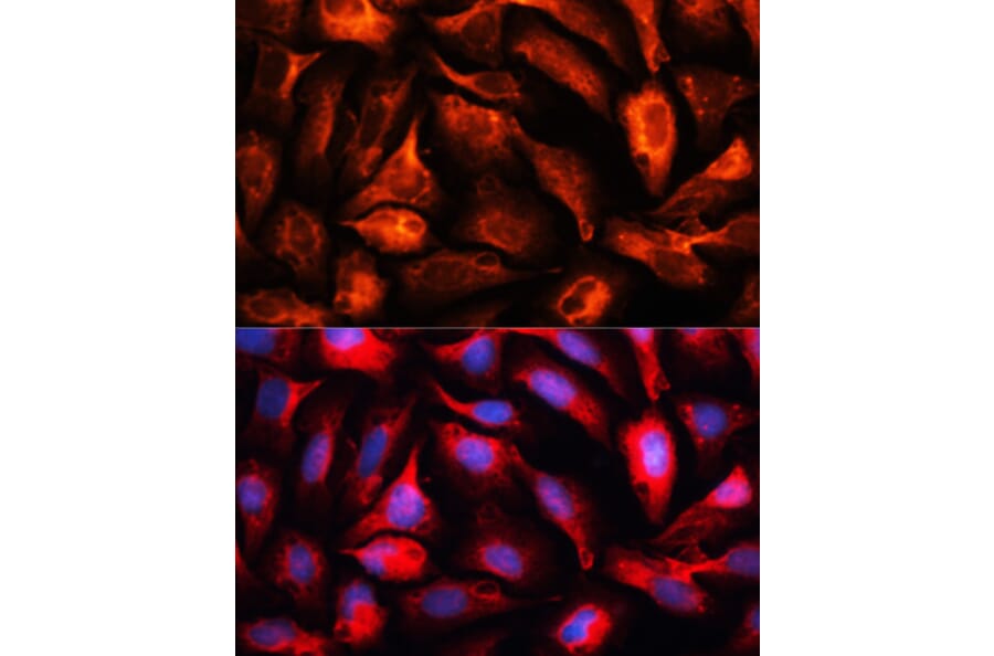Immunofluorescence - Anti-MAP1B Antibody (A14425) - Antibodies.com