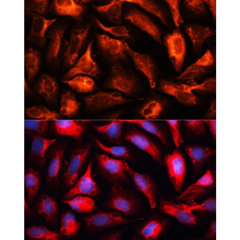 Immunofluorescence - Anti-MAP1B Antibody (A14425) - Antibodies.com