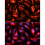 Immunofluorescence - Anti-MAP1B Antibody (A14425) - Antibodies.com