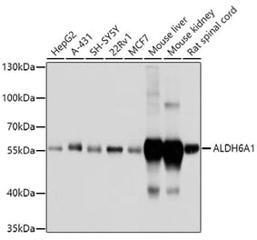 Western Blot - Anti-ALDH6A1 Antibody (A14426) - Antibodies.com