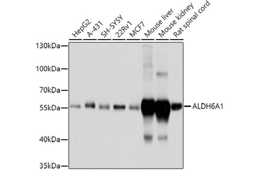 Western Blot - Anti-ALDH6A1 Antibody (A14426) - Antibodies.com