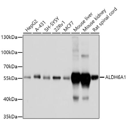 Western Blot - Anti-ALDH6A1 Antibody (A14426) - Antibodies.com