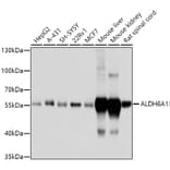 Western Blot - Anti-ALDH6A1 Antibody (A14426) - Antibodies.com