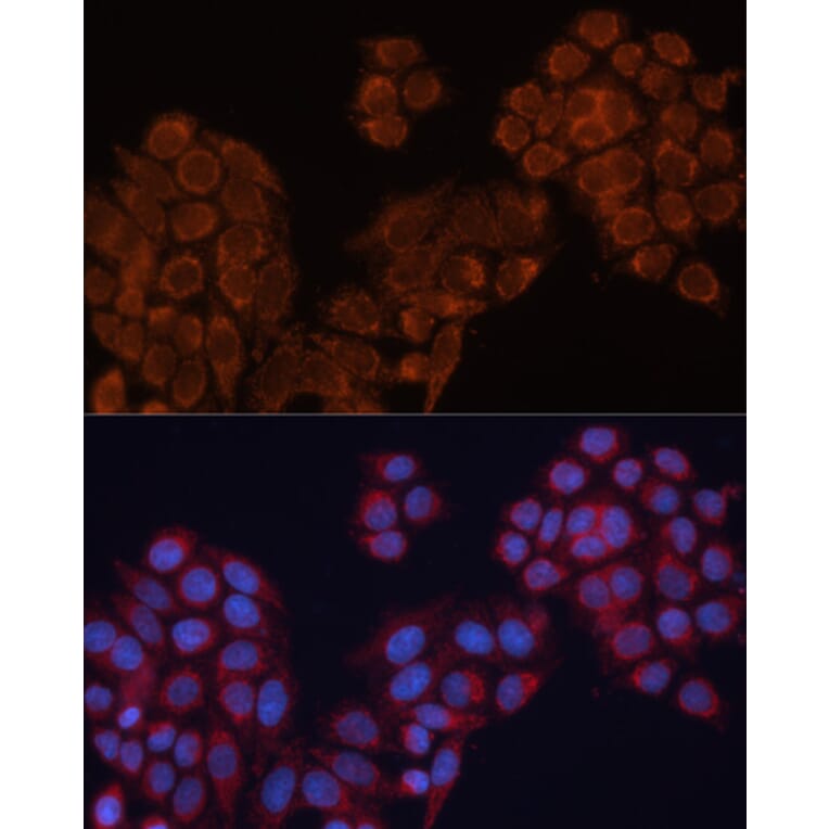 Immunofluorescence - Anti-ALDH6A1 Antibody (A14426) - Antibodies.com