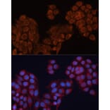 Immunofluorescence - Anti-ALDH6A1 Antibody (A14426) - Antibodies.com