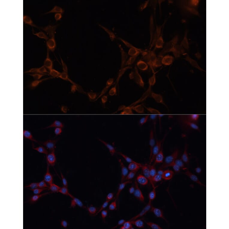 Immunofluorescence - Anti-ALDH6A1 Antibody (A14426) - Antibodies.com