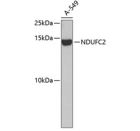 Western Blot - Anti-NDUFC2 Antibody (A14427) - Antibodies.com