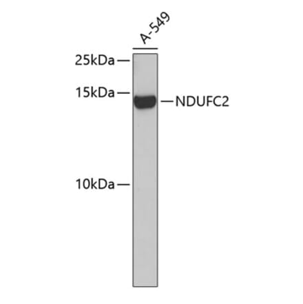 Western Blot - Anti-NDUFC2 Antibody (A14427) - Antibodies.com