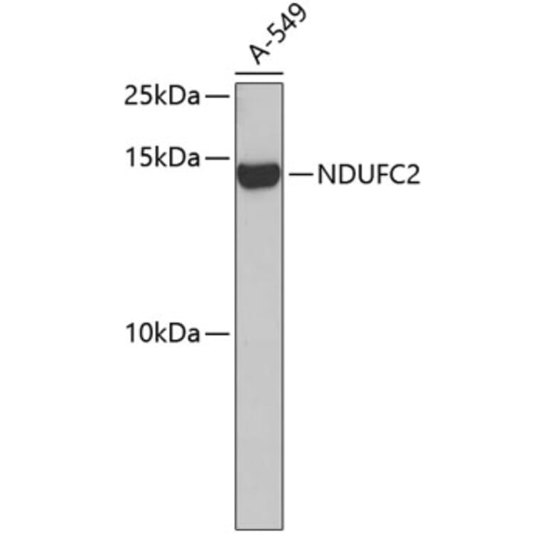 Western Blot - Anti-NDUFC2 Antibody (A14427) - Antibodies.com