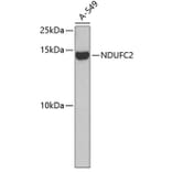 Western Blot - Anti-NDUFC2 Antibody (A14427) - Antibodies.com