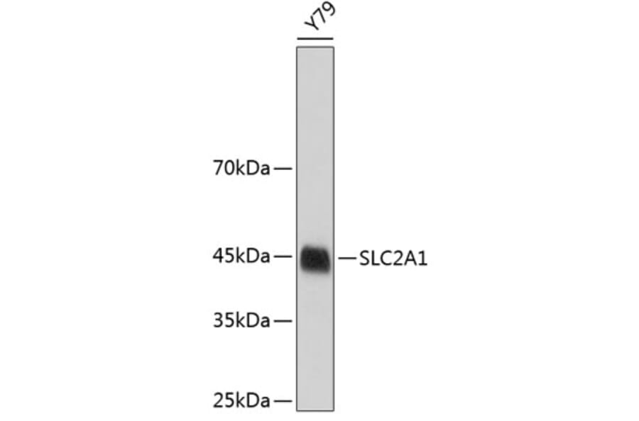 Western Blot - Anti-SLC2A1 Antibody (A3330) - Antibodies.com