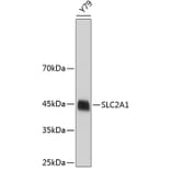 Western Blot - Anti-SLC2A1 Antibody (A3330) - Antibodies.com