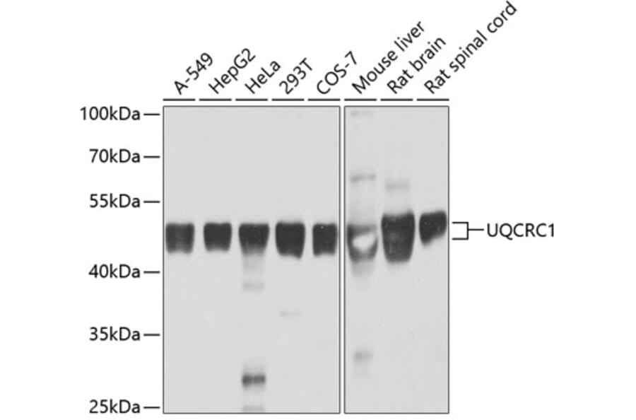 Western Blot - Anti-Ubiquinol-Cytochrome C Reductase Core Protein I Antibody (A14429) - Antibodies.com