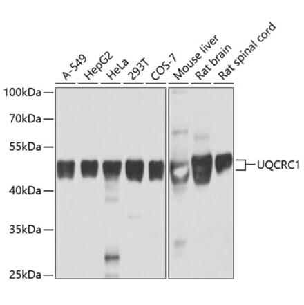 Western Blot - Anti-Ubiquinol-Cytochrome C Reductase Core Protein I Antibody (A14429) - Antibodies.com