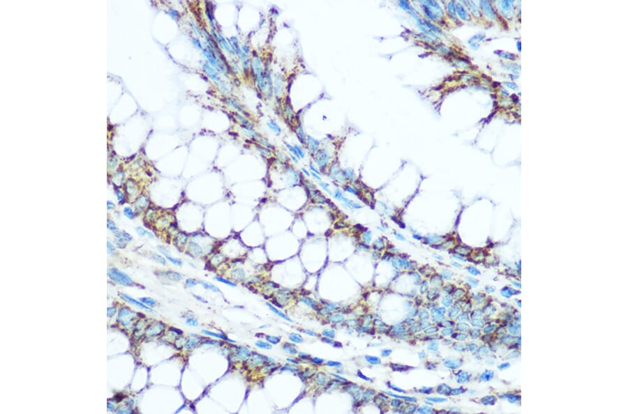 Immunohistochemistry - Anti-Ubiquinol-Cytochrome C Reductase Core Protein I Antibody (A14429) - Antibodies.com