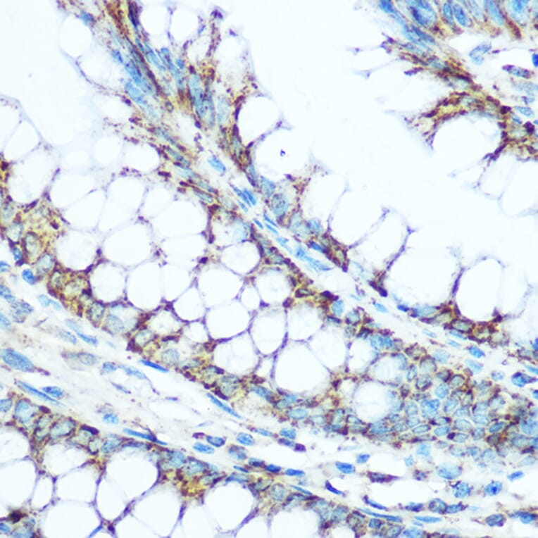 Immunohistochemistry - Anti-Ubiquinol-Cytochrome C Reductase Core Protein I Antibody (A14429) - Antibodies.com