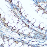 Immunohistochemistry - Anti-Ubiquinol-Cytochrome C Reductase Core Protein I Antibody (A14429) - Antibodies.com