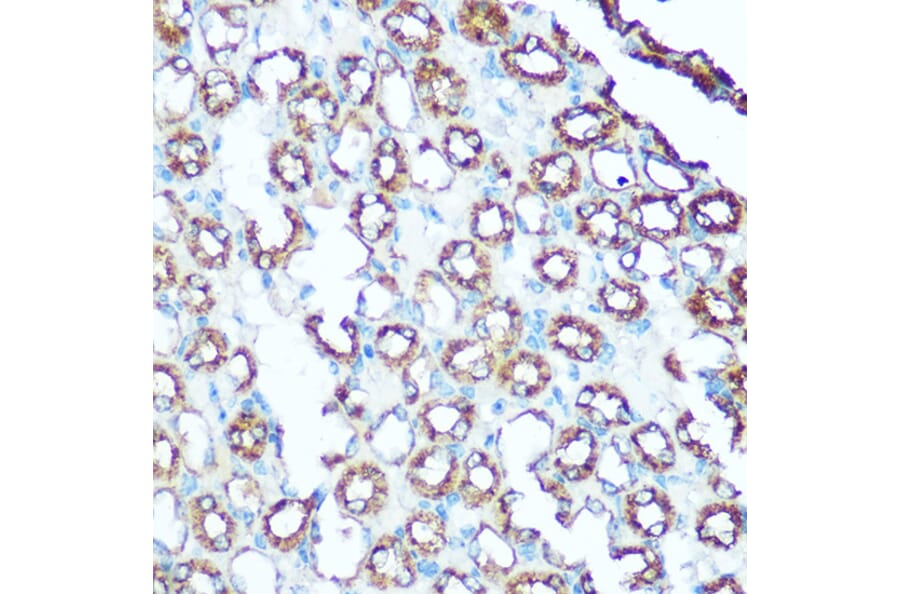 Immunohistochemistry - Anti-Ubiquinol-Cytochrome C Reductase Core Protein I Antibody (A14429) - Antibodies.com