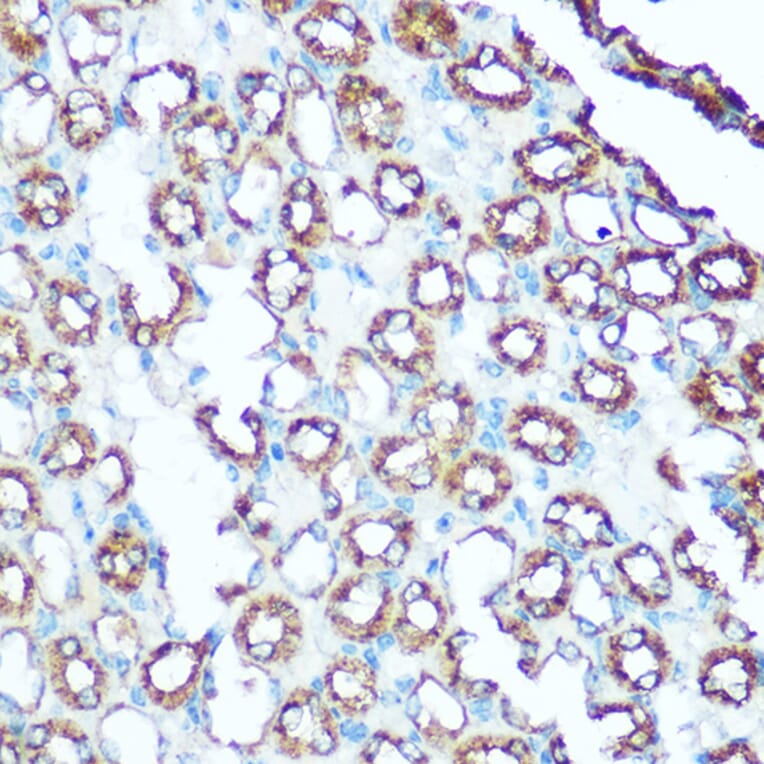 Immunohistochemistry - Anti-Ubiquinol-Cytochrome C Reductase Core Protein I Antibody (A14429) - Antibodies.com