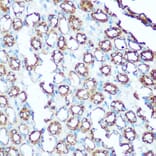 Immunohistochemistry - Anti-Ubiquinol-Cytochrome C Reductase Core Protein I Antibody (A14429) - Antibodies.com
