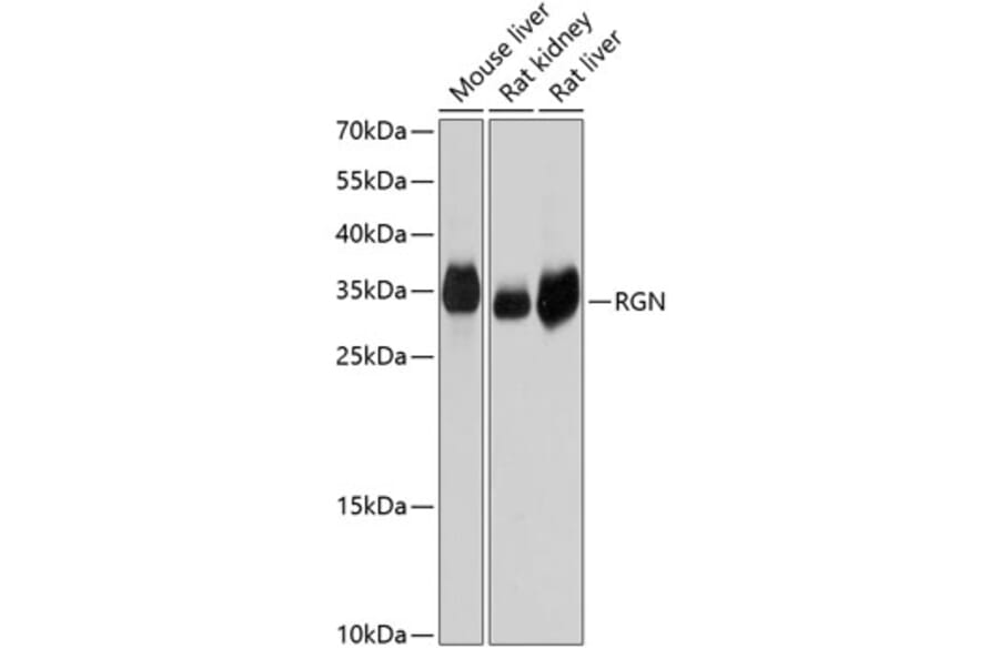 Western Blot - Anti-SMP30 Antibody (A14430) - Antibodies.com