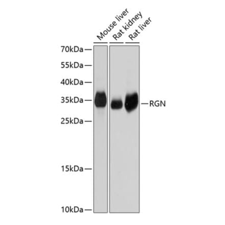 Western Blot - Anti-SMP30 Antibody (A14430) - Antibodies.com