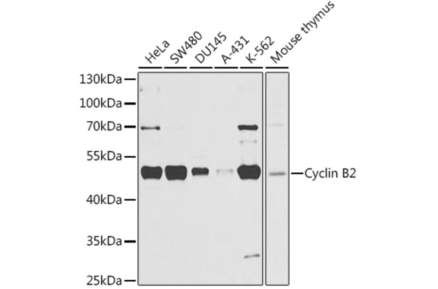 Western Blot - Anti-Cyclin B2/CCNB2 Antibody (A14431) - Antibodies.com