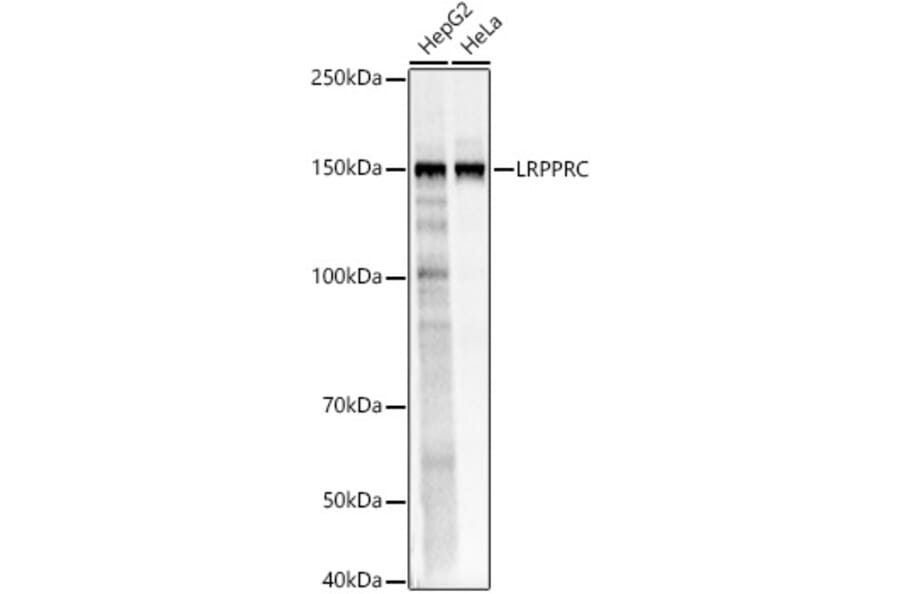 Western Blot - Anti-LRPPRC/GP130 Antibody (A14432) - Antibodies.com