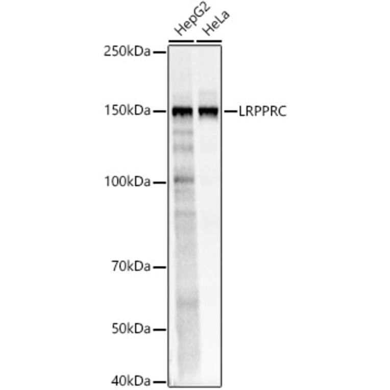 Western Blot - Anti-LRPPRC/GP130 Antibody (A14432) - Antibodies.com